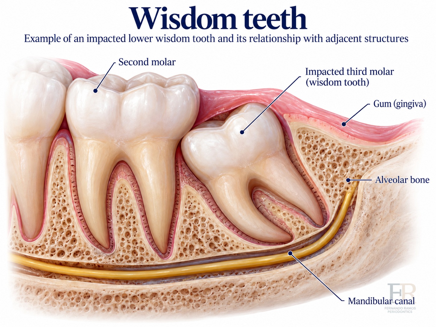 Minor oral surgery · Educational illustration
